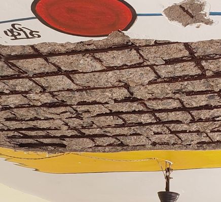 मुंगेली के स्कूल में बड़ा हादसा, छत का प्लास्टर गिरने से छात्रा घायल