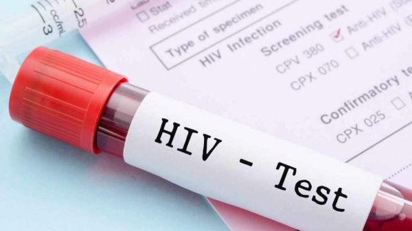 HIV रिपोर्ट की जानकारी अब केवल डॉक्टर रख सकेंगे, फाइलों पर नहीं होंगे चिन्ह, गोपनीयता को लेकर गाइडलाइन जारी